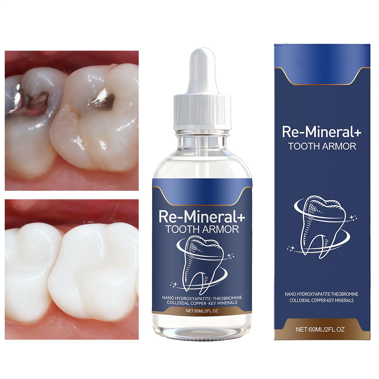Teeth Whitening Gum - سائل تنظيف الأسنان 60 مل يزيل