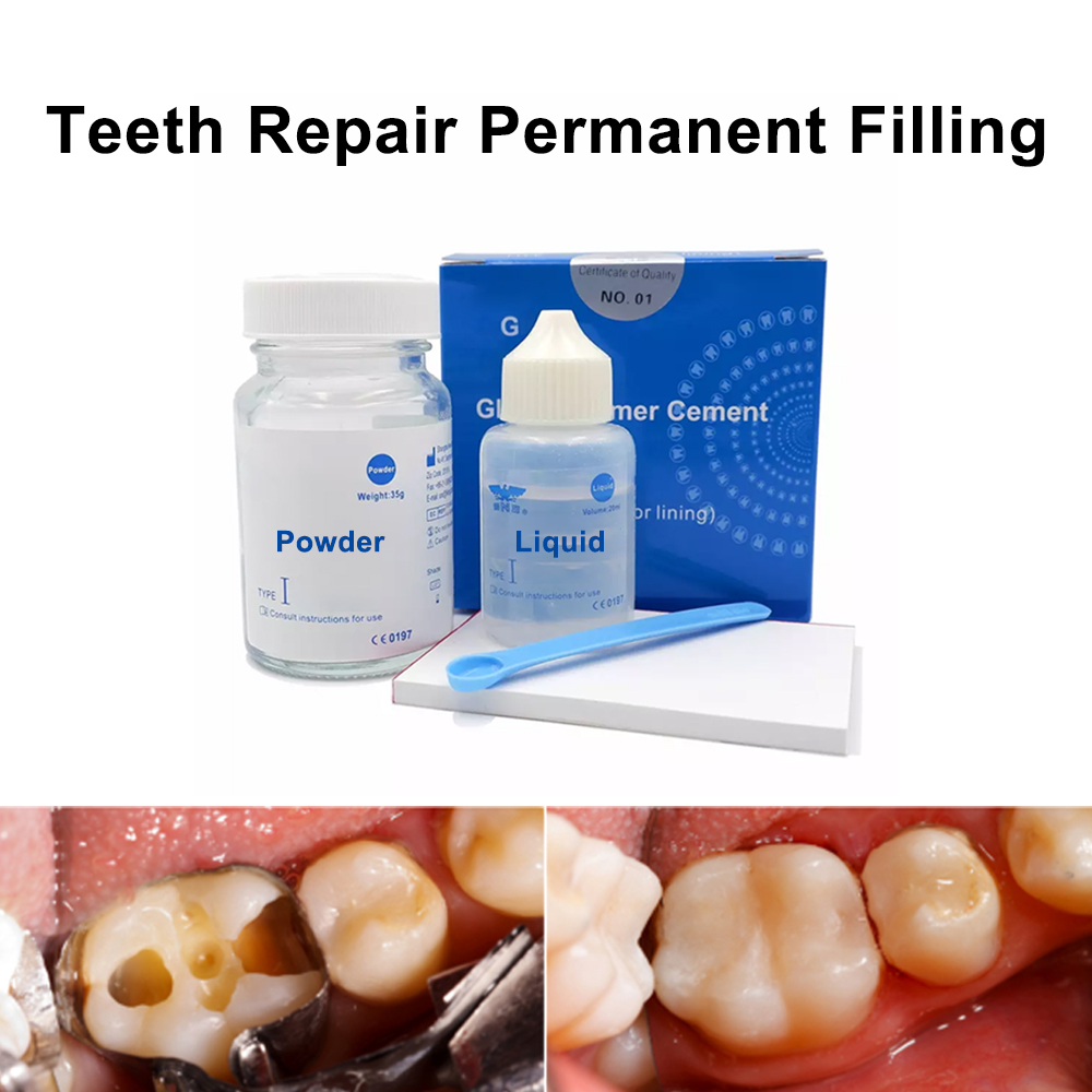 Teeth Whitening At Home Kit - دائم الأسنان ملء طقم إصلاح في