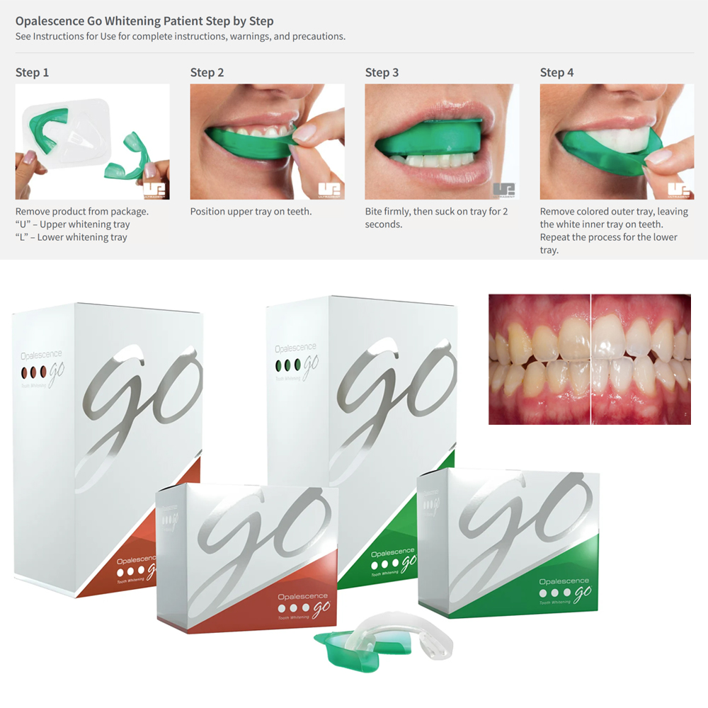 Teeth Whitening At Home Kit - صواني تبييض الأسنان Opalescence Go ،