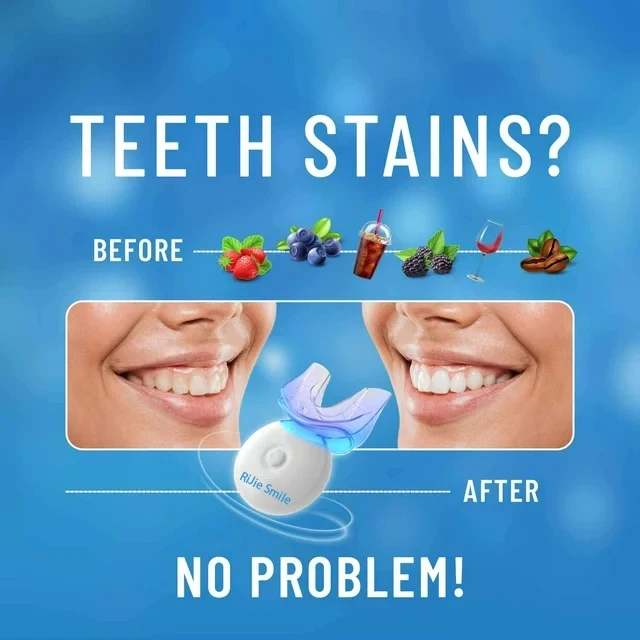 طقم تنظيف عالي الجودة، أجهزة ت - مراجعة Teeth Whitening At Home Kit وسعره