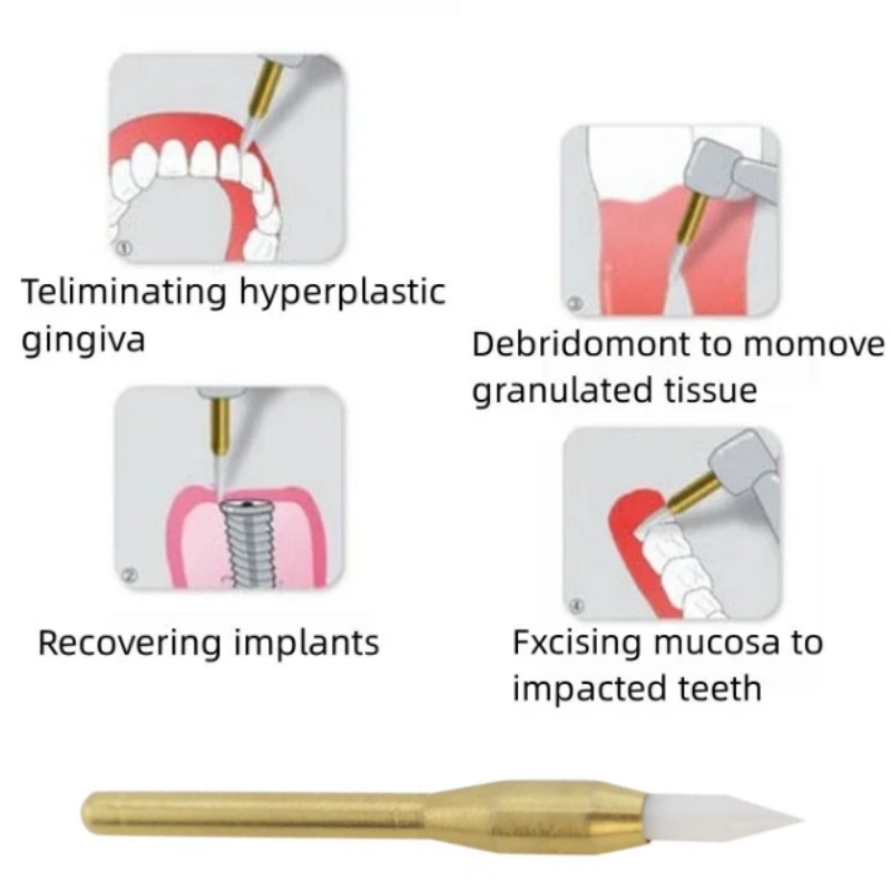 أزيز تشذيب الأسنان الناعمة الج - مراجعة Teeth Whitening Gum وسعره